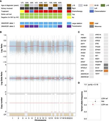 Molecular Characterization of the Tumor Microenvironment in Renal Medullary Carcinoma